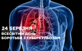 24 березня відзначають Всесвітній день боротьби з туберкульозом