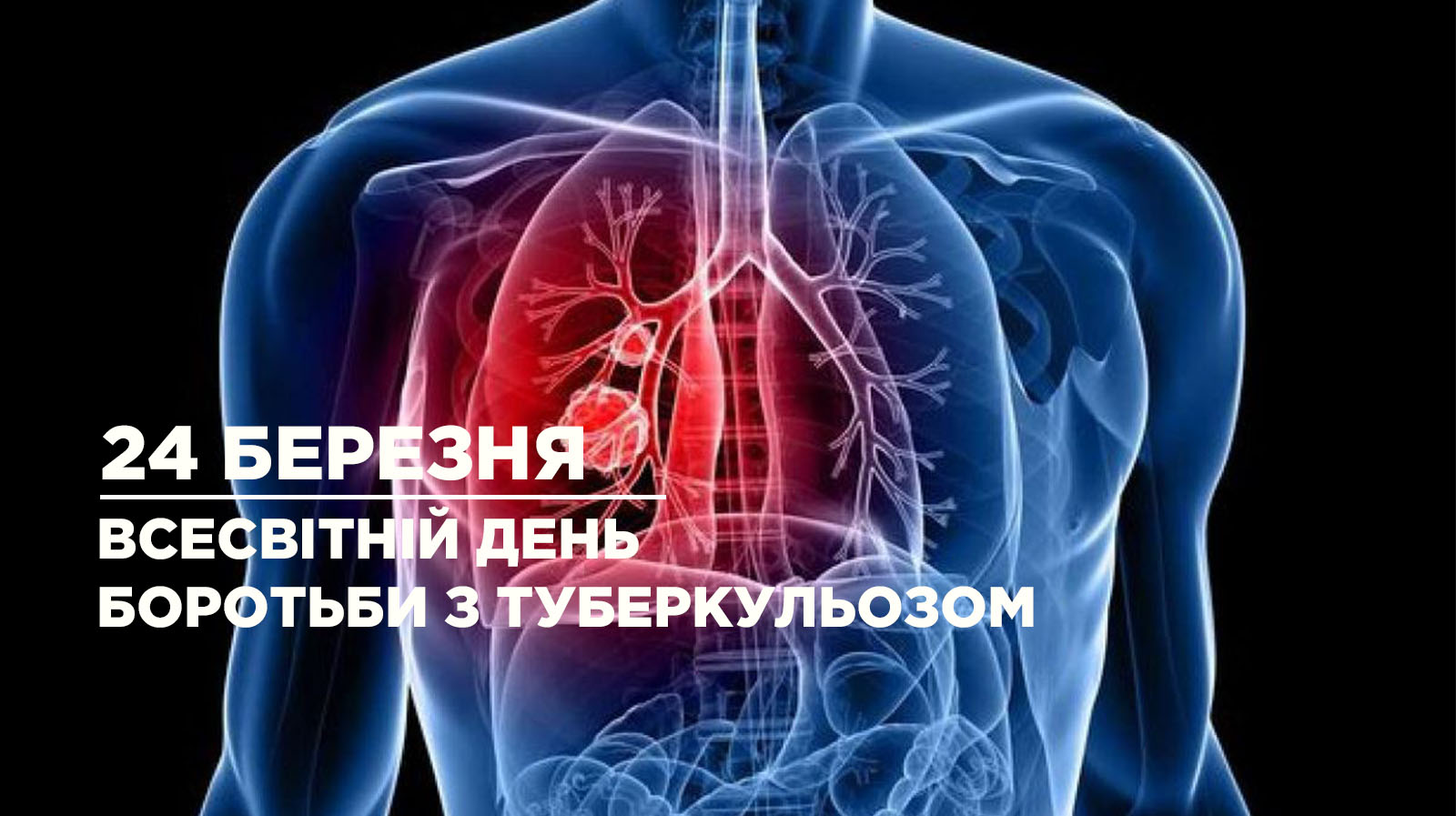 24 березня відзначають Всесвітній день боротьби з туберкульозом